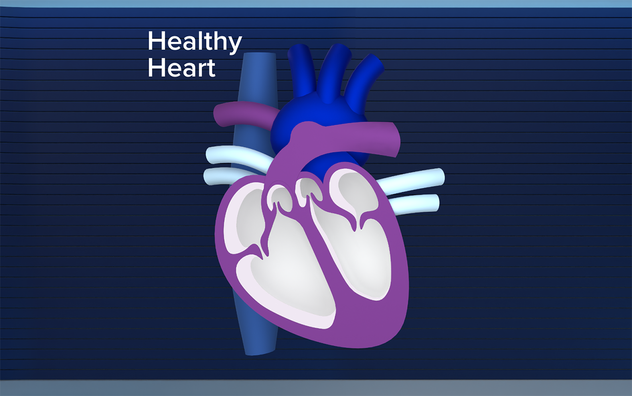 OHCM Heart Healthy